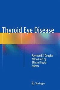 bokomslag Thyroid Eye Disease