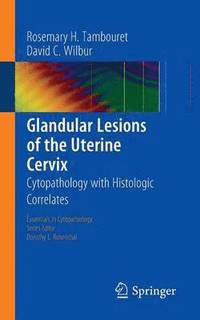 bokomslag Glandular Lesions of the Uterine Cervix