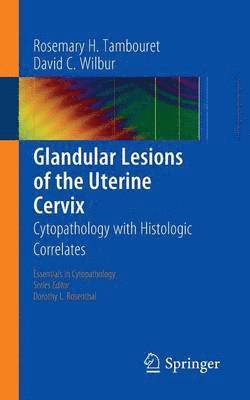 Glandular Lesions of the Uterine Cervix 1