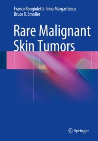 bokomslag Rare Malignant Skin Tumors