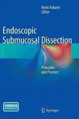 Endoscopic Submucosal Dissection 1