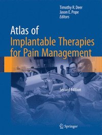 bokomslag Atlas of Implantable Therapies for Pain Management