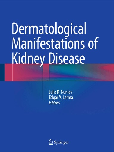 Julia R. Nunley, Edgar V. Lerma - Dermatological Manifestations of Kidney Disease, Inbunden