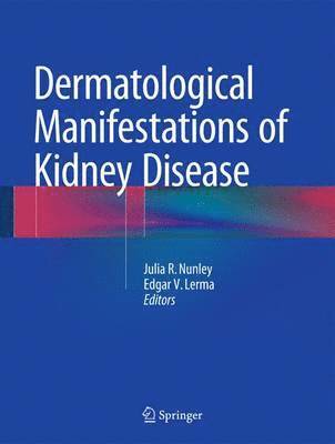 bokomslag Dermatological Manifestations of Kidney Disease