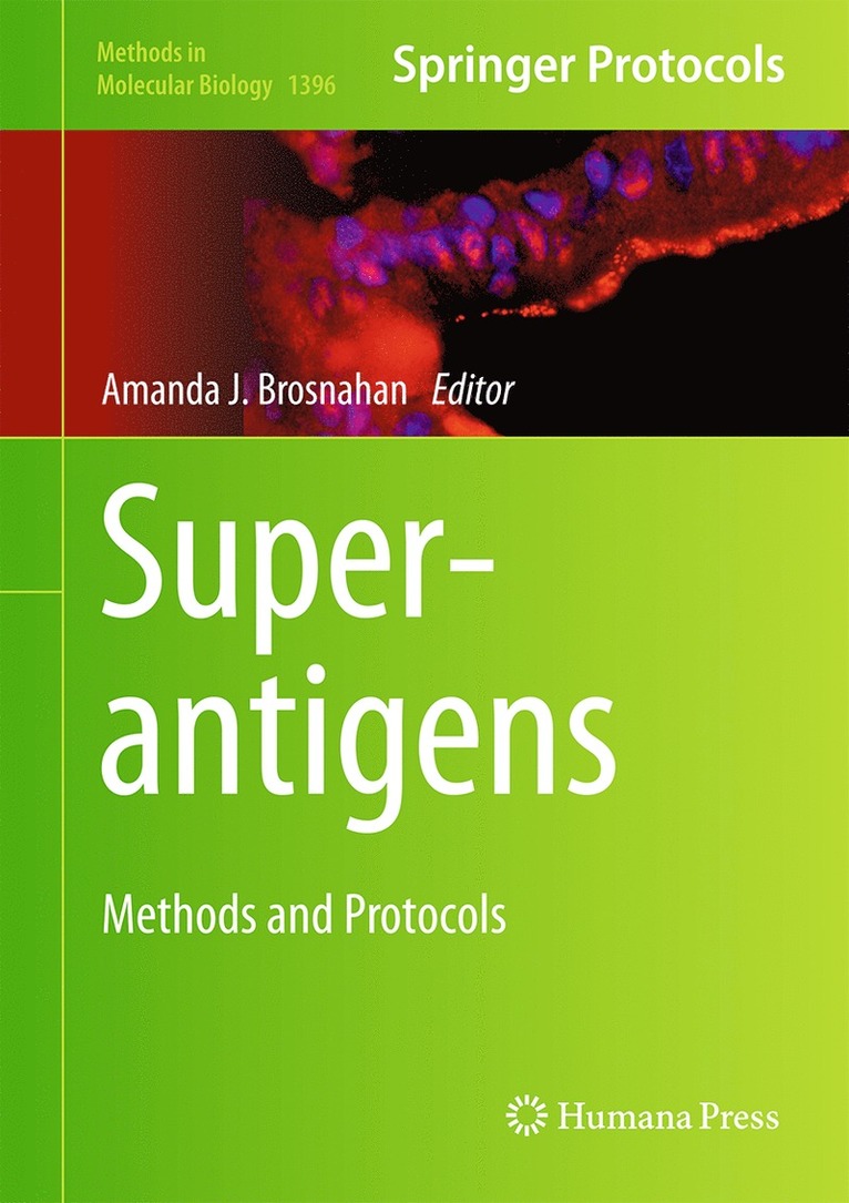 Amanda J. Brosnahan - Superantigens, Inbunden