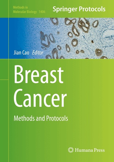 Jian Cao - Breast Cancer, Inbunden