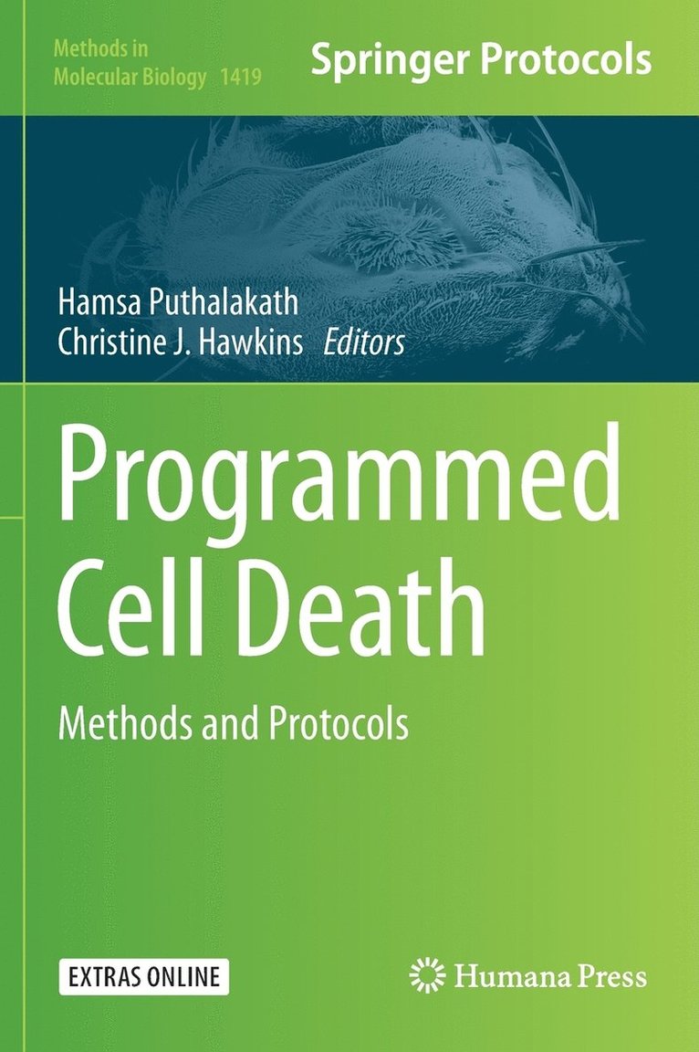 Programmed Cell Death 1