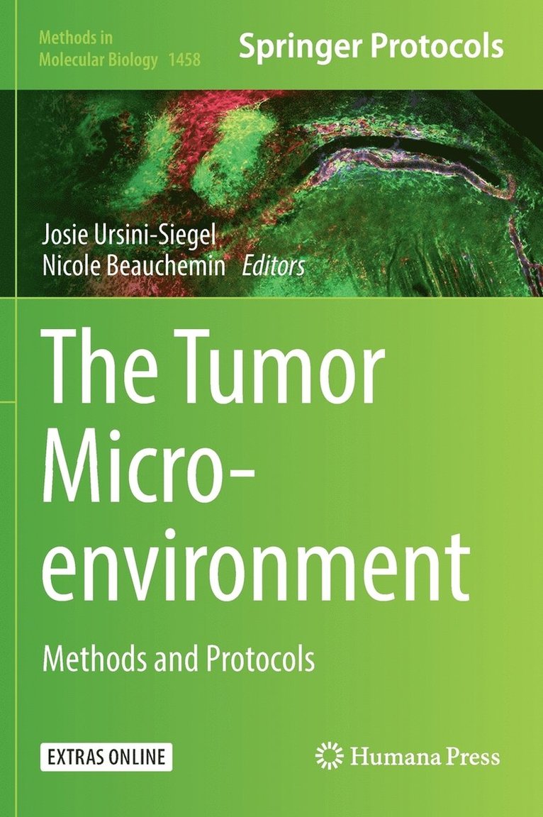 The Tumor Microenvironment 1