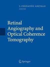 bokomslag Retinal Angiography and Optical Coherence Tomography