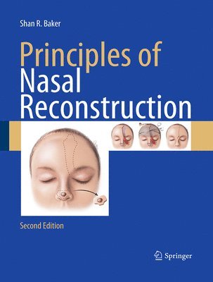 bokomslag Principles of Nasal Reconstruction