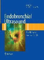 bokomslag Endobronchial Ultrasound