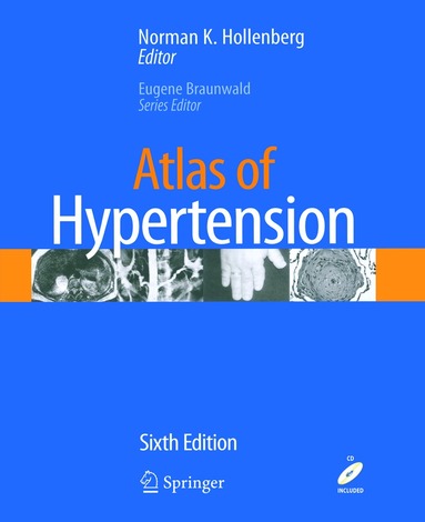 Norman K. Hollenberg - Atlas of Hypertension, Häftad