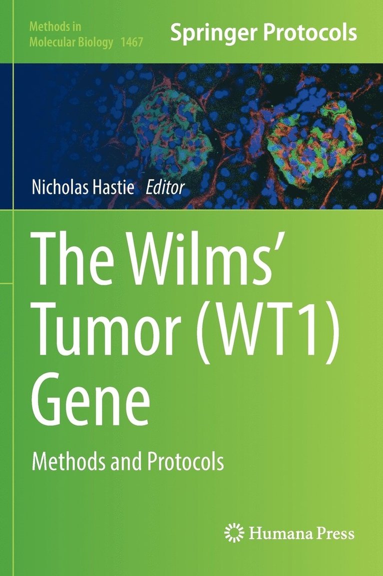 Wilms' Tumor (WT1) Gene
