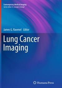 bokomslag Lung Cancer Imaging