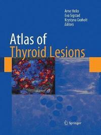 bokomslag Atlas of Thyroid Lesions