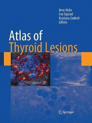 bokomslag Atlas of Thyroid Lesions