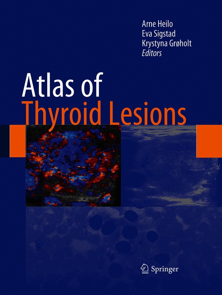 Arne Heilo, Eva Sigstad, Krystyna Grøholt - Atlas of Thyroid Lesions, Häftad