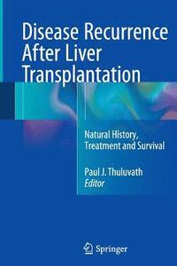 bokomslag Disease Recurrence After Liver Transplantation