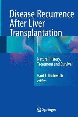 Paul J. Thuluvath - Disease Recurrence After Liver Transplantation, Häftad