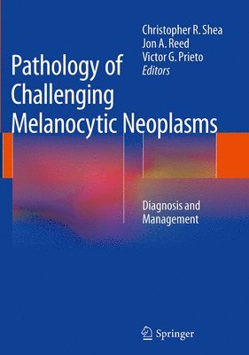 bokomslag Pathology of Challenging Melanocytic Neoplasms