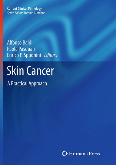 Alfonso Baldi, Paola Pasquali, Enrico P Spugnini - Skin Cancer, Häftad