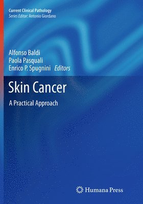 Alfonso Baldi, Paola Pasquali, Enrico P Spugnini - Skin Cancer, Häftad
