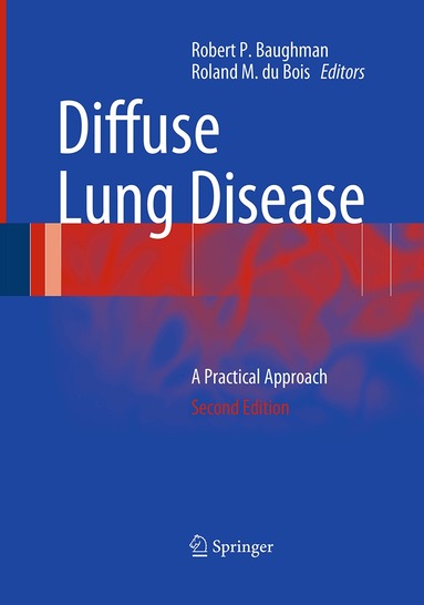 Robert P. Baughman, Roland M. du Bois - Diffuse Lung Disease, Häftad
