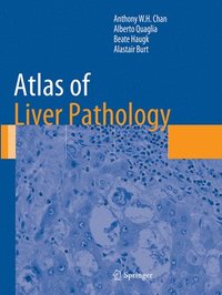 bokomslag Atlas of Liver Pathology