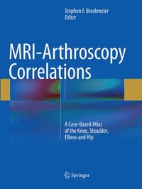 bokomslag MRI-Arthroscopy Correlations
