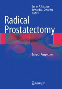 bokomslag Radical Prostatectomy