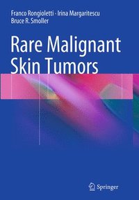 bokomslag Rare Malignant Skin Tumors