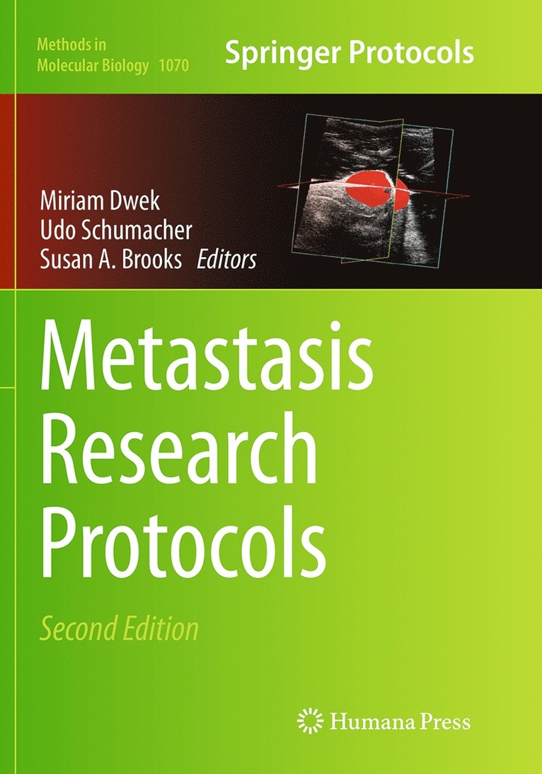 Metastasis Research Protocols 1