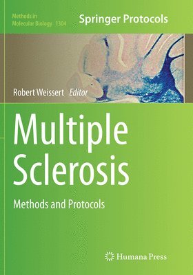 bokomslag Multiple Sclerosis