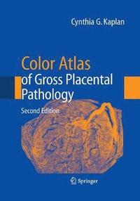 bokomslag Color Atlas of Gross Placental Pathology