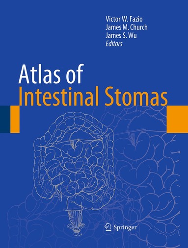 Victor W. Fazio, James M. Church, James S. Wu - Atlas of Intestinal Stomas, Häftad