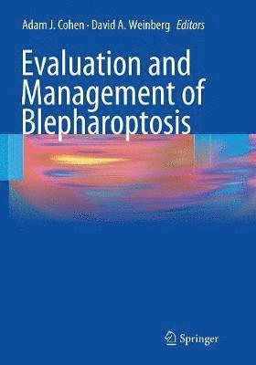 Evaluation and Management of Blepharoptosis 1