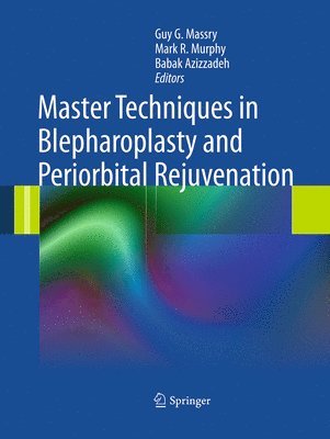 Master Techniques in Blepharoplasty and Periorbital Rejuvenation 1
