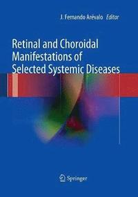 bokomslag Retinal and Choroidal Manifestations of Selected Systemic Diseases