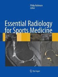 bokomslag Essential Radiology for Sports Medicine