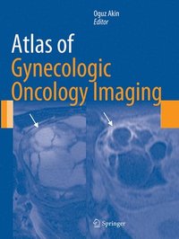 bokomslag Atlas of Gynecologic Oncology Imaging