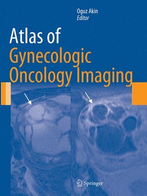 bokomslag Atlas of Gynecologic Oncology Imaging