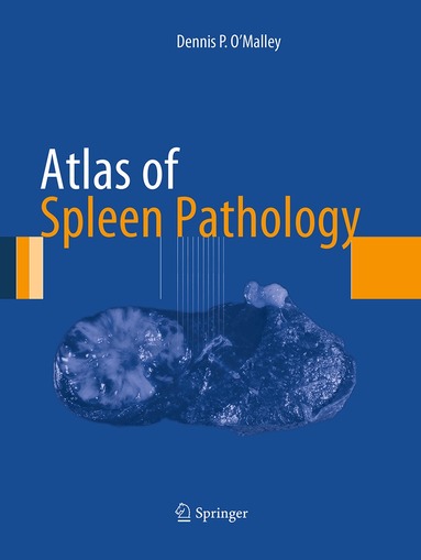 Dennis P. O'Malley - Atlas of Spleen Pathology, Häftad