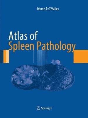 bokomslag Atlas of Spleen Pathology