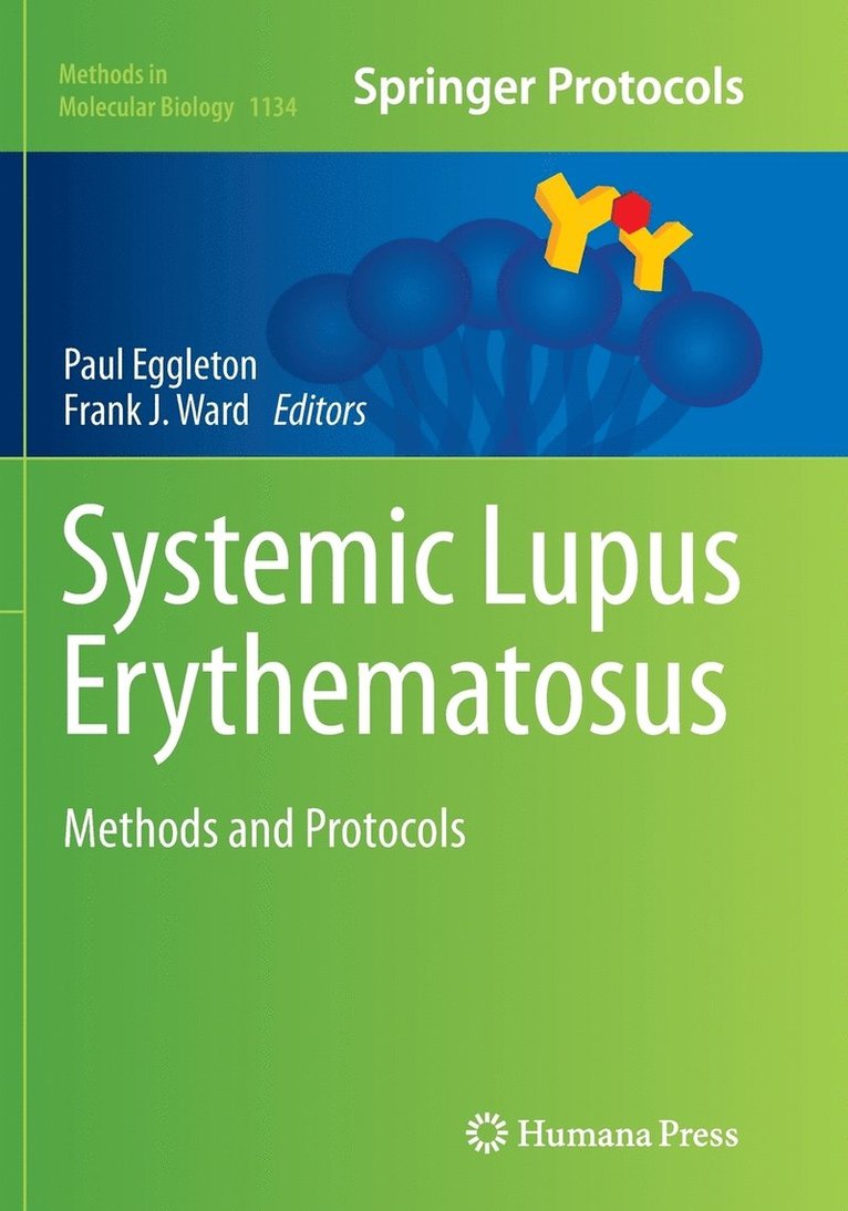 Systemic Lupus Erythematosus