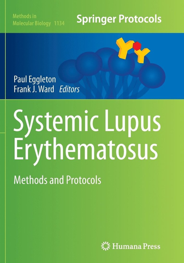 Systemic Lupus Erythematosus 1