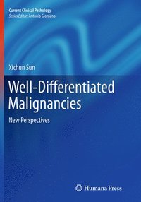 bokomslag Well-Differentiated Malignancies