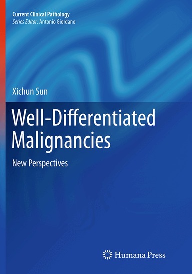Xichun Sun - Well-Differentiated Malignancies, Häftad