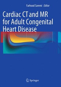 bokomslag Cardiac CT and MR for Adult Congenital Heart Disease