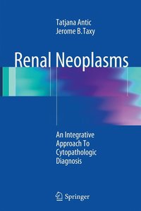 bokomslag Renal Neoplasms