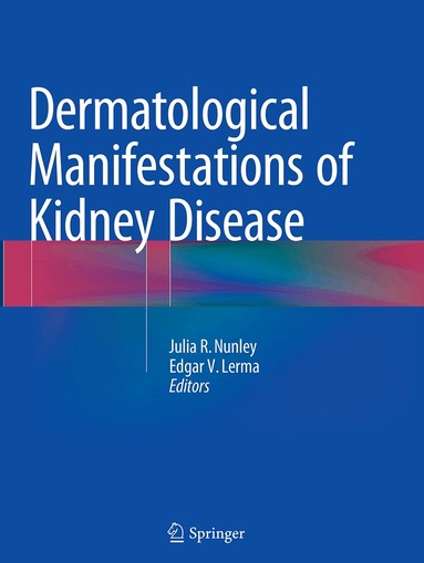 Julia R. Nunley, Edgar V. Lerma - Dermatological Manifestations of Kidney Disease, Häftad
